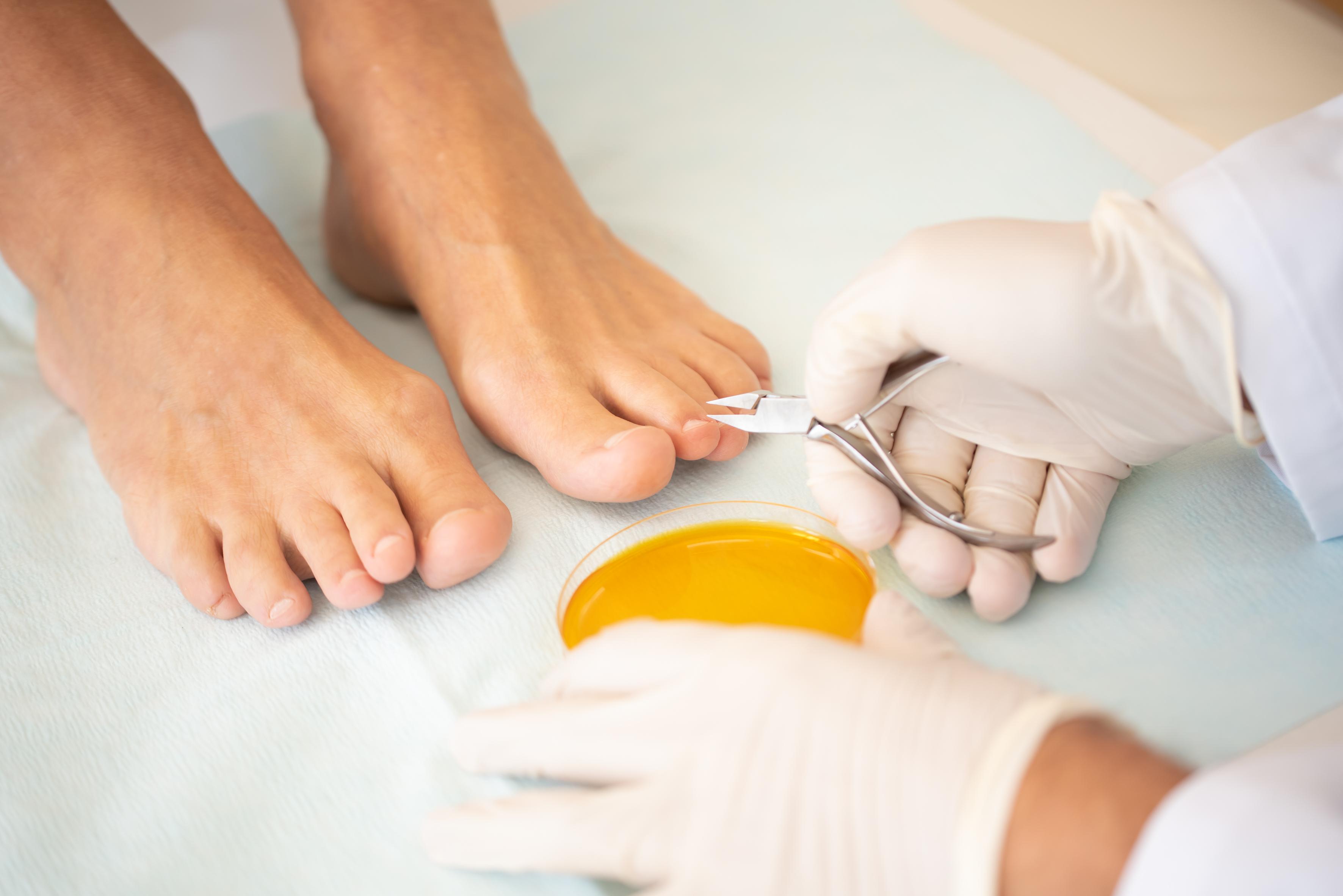 Zentrum für Nagelerkrankungen