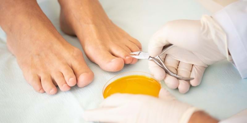 Zentrum für Nagelerkrankungen